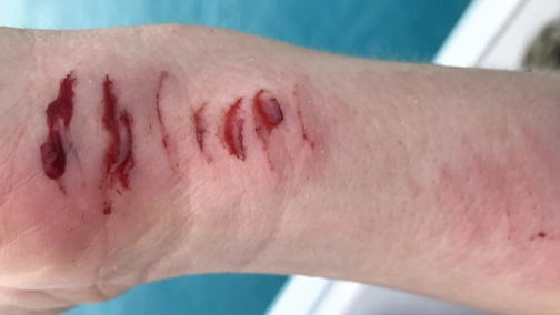 Акулы разбушевались!