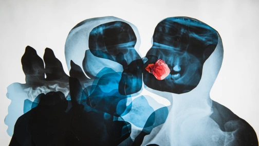 O!PLA. Focus on Poland 2022